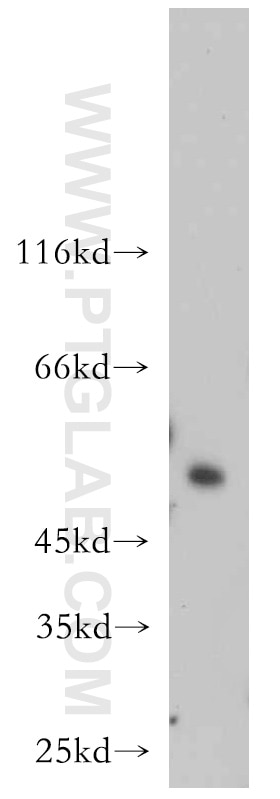 Western Blot (WB) analysis of HeLa cells using SESN3 Polyclonal antibody (11431-2-AP)