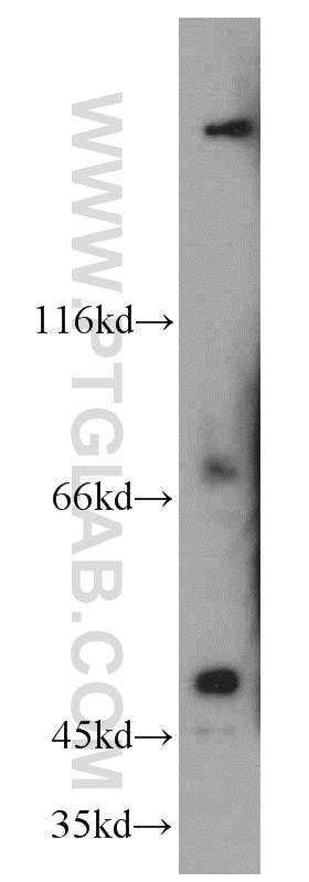 Western Blot (WB) analysis of HepG2 cells using SESN3 Polyclonal antibody (11431-2-AP)