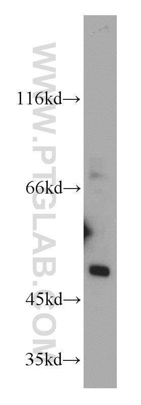 Western Blot (WB) analysis of HeLa cells using SESN3 Polyclonal antibody (11431-2-AP)