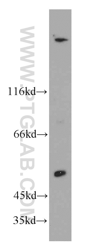 Western Blot (WB) analysis of A549 cells using SESN3 Polyclonal antibody (11431-2-AP)