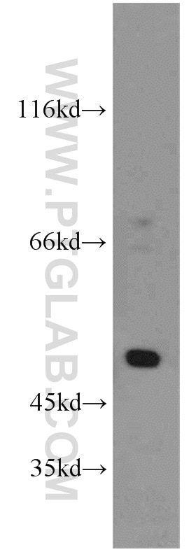 Western Blot (WB) analysis of HeLa cells using SESN3 Polyclonal antibody (11431-2-AP)