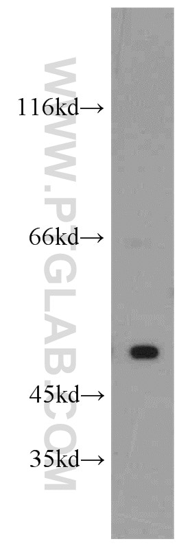 Western Blot (WB) analysis of HeLa cells using SESN3 Polyclonal antibody (11431-2-AP)