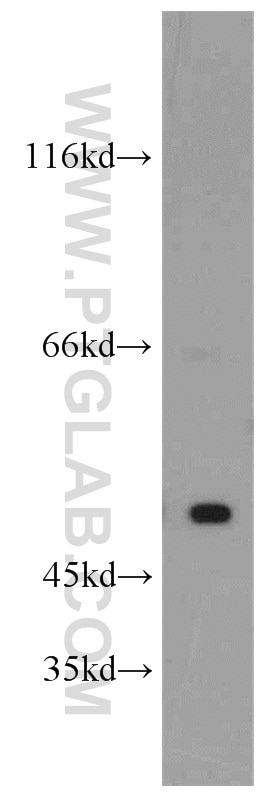 WB analysis of HeLa using 11431-2-AP