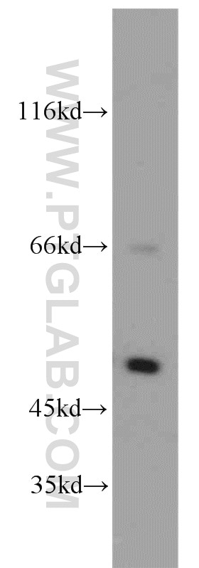 Western Blot (WB) analysis of HEK-293 cells using SESN3 Polyclonal antibody (11431-2-AP)