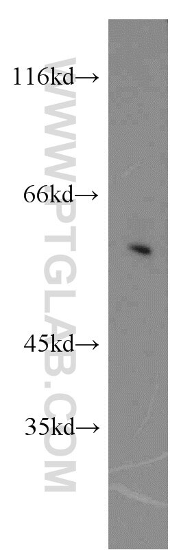 Western Blot (WB) analysis of mouse liver tissue using SESN3 Polyclonal antibody (11431-2-AP)