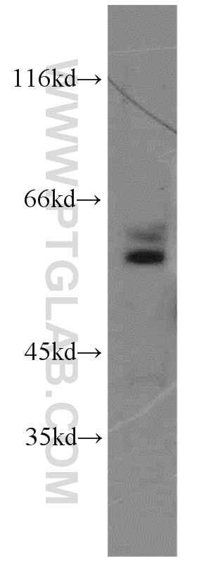 Western Blot (WB) analysis of mouse liver tissue using SESN3 Polyclonal antibody (11431-2-AP)