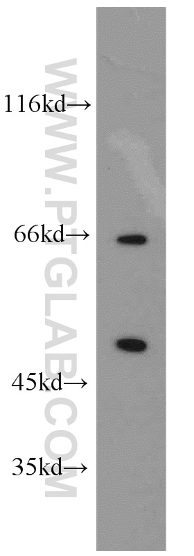 Western Blot (WB) analysis of A431 cells using SESN3 Polyclonal antibody (11431-2-AP)