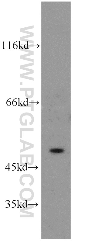 Western Blot (WB) analysis of A431 cells using SESN3 Polyclonal antibody (11431-2-AP)