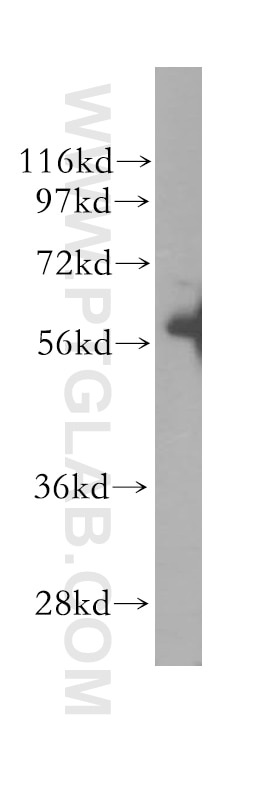 Western Blot (WB) analysis of mouse ovary tissue using SESN3 Polyclonal antibody (11431-2-AP)