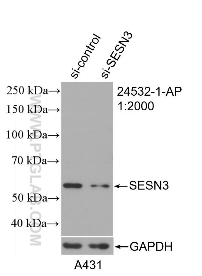 Western Blot (WB) analysis of A431 cells using SESN3 Polyclonal antibody (24532-1-AP)
