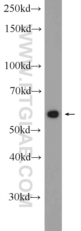 Western Blot (WB) analysis of HepG2 cells using SESN3 Polyclonal antibody (24532-1-AP)