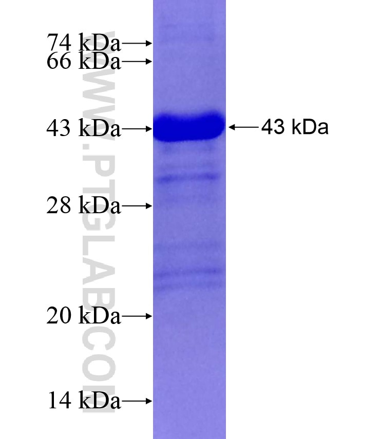 SESN3 fusion protein Ag17872 SDS-PAGE