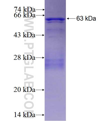 SESN3 fusion protein Ag1961 SDS-PAGE