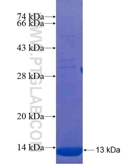 SESN3 fusion protein Ag21380 SDS-PAGE