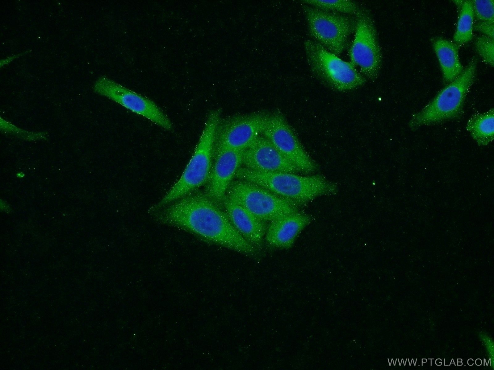 Immunofluorescence (IF) / fluorescent staining of HepG2 cells using SOLO Polyclonal antibody (23911-1-AP)