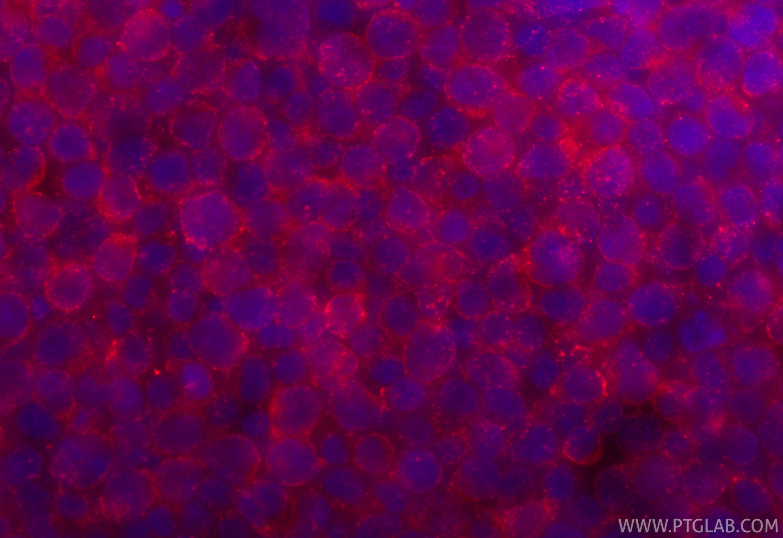 Immunofluorescent analysis of (4% PFA) fixed Jurkat cells using SOLO antibody (23911-1-AP) at dilution of 1:200 and CoraLite®594-Conjugated Goat Anti-Rabbit IgG(H+L) (SA00013-4). Immunofluorescence (IF) / fluorescent staining of Jurkat cells using SOLO/SESTD1 Polyclonal antibody (23911-1-AP)