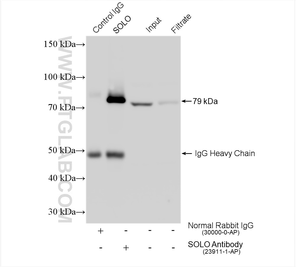 Immunoprecipitation (IP) experiment of mouse brain tissue using SOLO Polyclonal antibody (23911-1-AP)