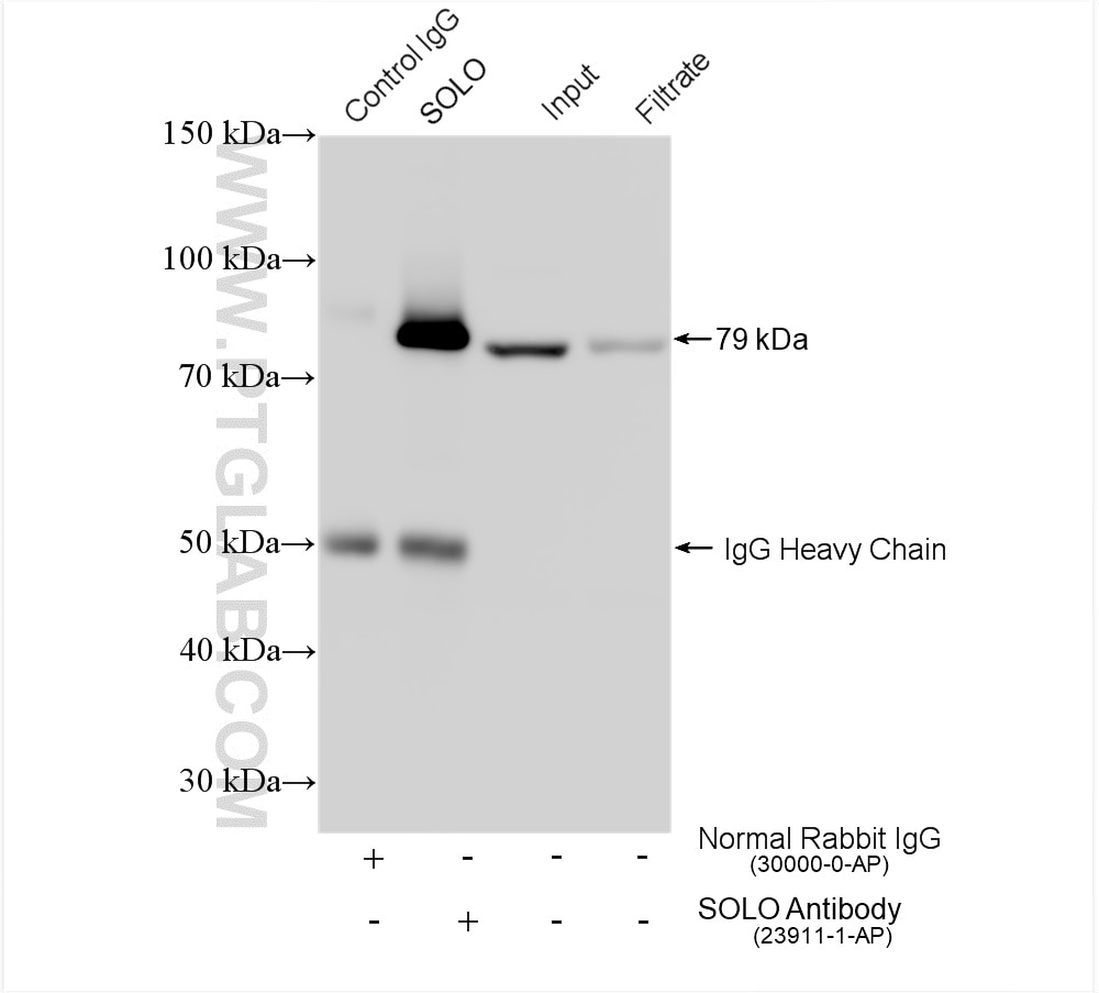 Immunoprecipitation (IP) experiment of rat brain tissue using SOLO Polyclonal antibody (23911-1-AP)