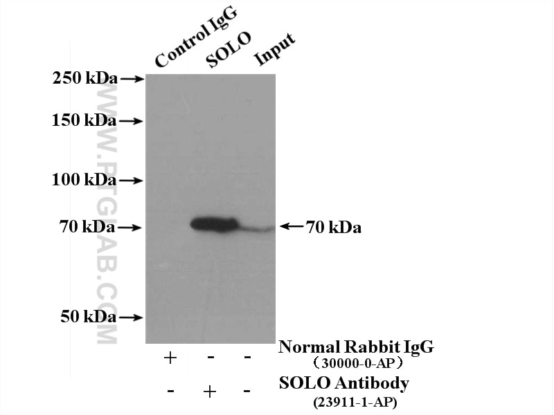 Immunoprecipitation (IP) experiment of mouse brain tissue using SOLO Polyclonal antibody (23911-1-AP)