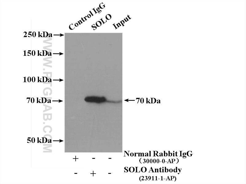 SOLO Polyclonal antibody