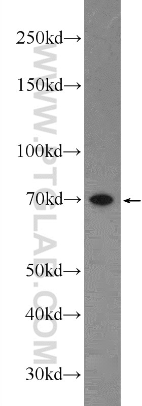 Western Blot (WB) analysis of MCF-7 cells using SOLO Polyclonal antibody (23911-1-AP)