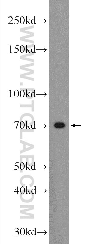 Western Blot (WB) analysis of HepG2 cells using SOLO Polyclonal antibody (23911-1-AP)