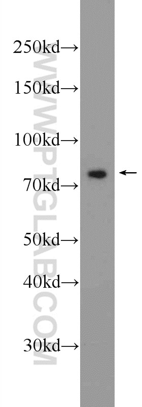 Western Blot (WB) analysis of Jurkat cells using SOLO Polyclonal antibody (23911-1-AP)