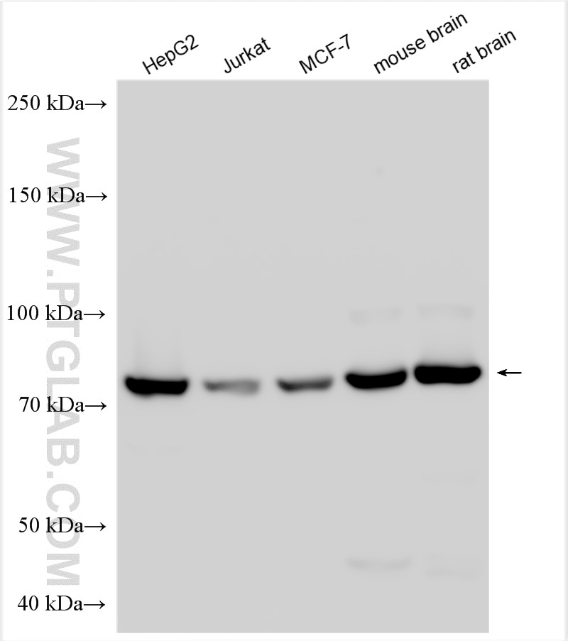 Western Blot (WB) analysis of various lysates using SOLO Polyclonal antibody (23911-1-AP)