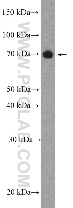 Western Blot (WB) analysis of rat brain tissue using SOLO Polyclonal antibody (23911-1-AP)