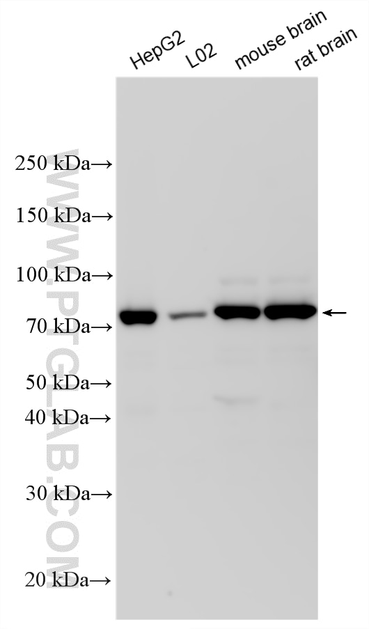 Various lysates were subjected to SDS PAGE followed by western blot with 23911-1-AP (SOLO/SESTD1 antibody) at dilution of 1:10000 incubated at room temperature for 1.5 hours. Western Blot (WB) analysis of various lysates using SOLO/SESTD1 Polyclonal antibody (23911-1-AP)
