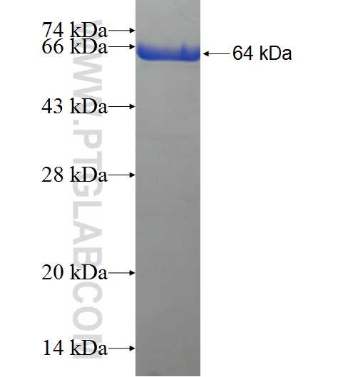 SESTD1 fusion protein Ag21016 SDS-PAGE