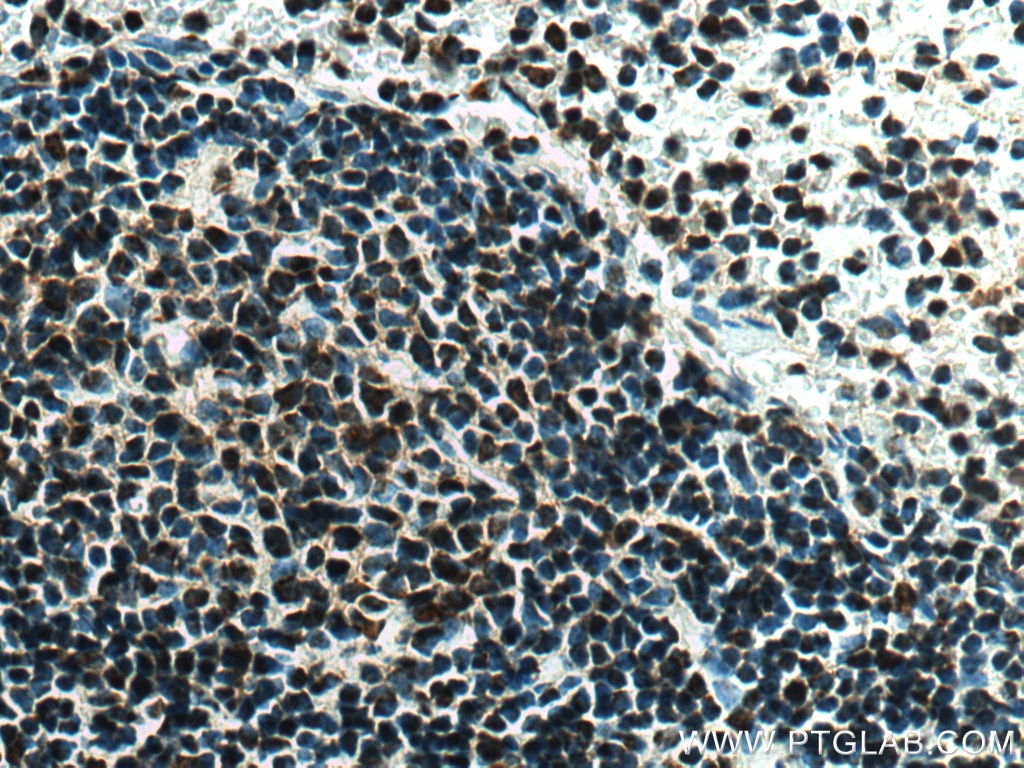 Immunohistochemistry (IHC) staining of mouse spleen tissue using SET/TAF-I Polyclonal antibody (55201-1-AP)