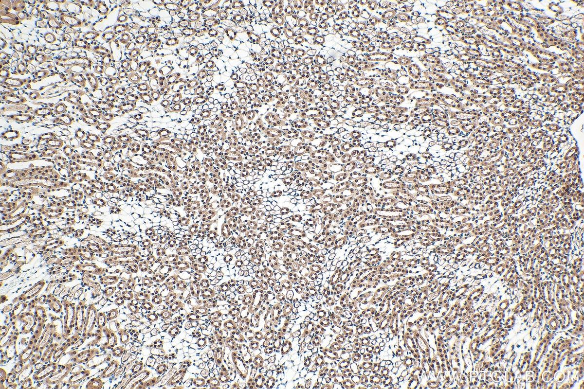 Immunohistochemistry (IHC) staining of mouse kidney tissue using SET/TAF-I Polyclonal antibody (55201-1-AP)
