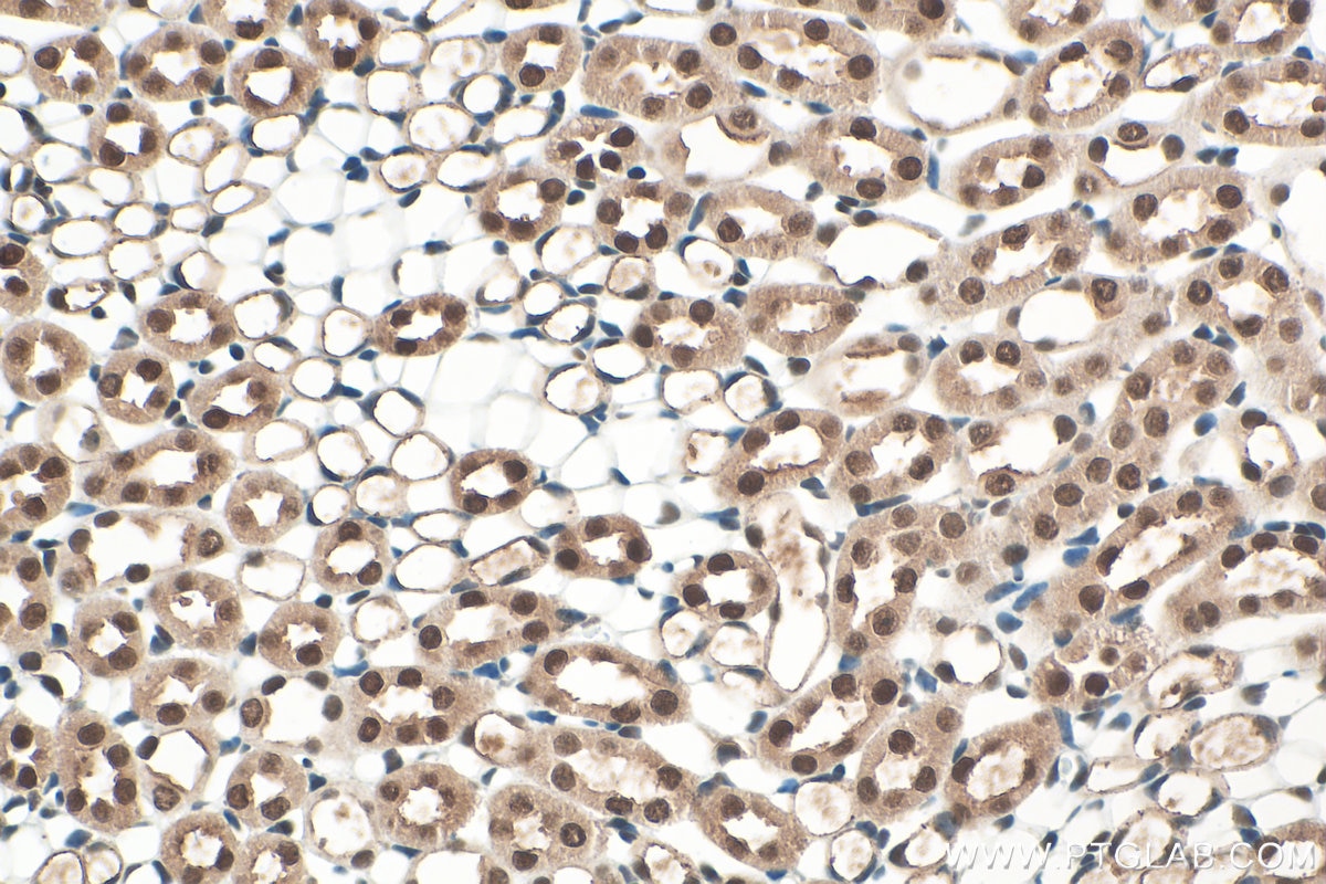 Immunohistochemistry (IHC) staining of mouse kidney tissue using SET/TAF-I Polyclonal antibody (55201-1-AP)