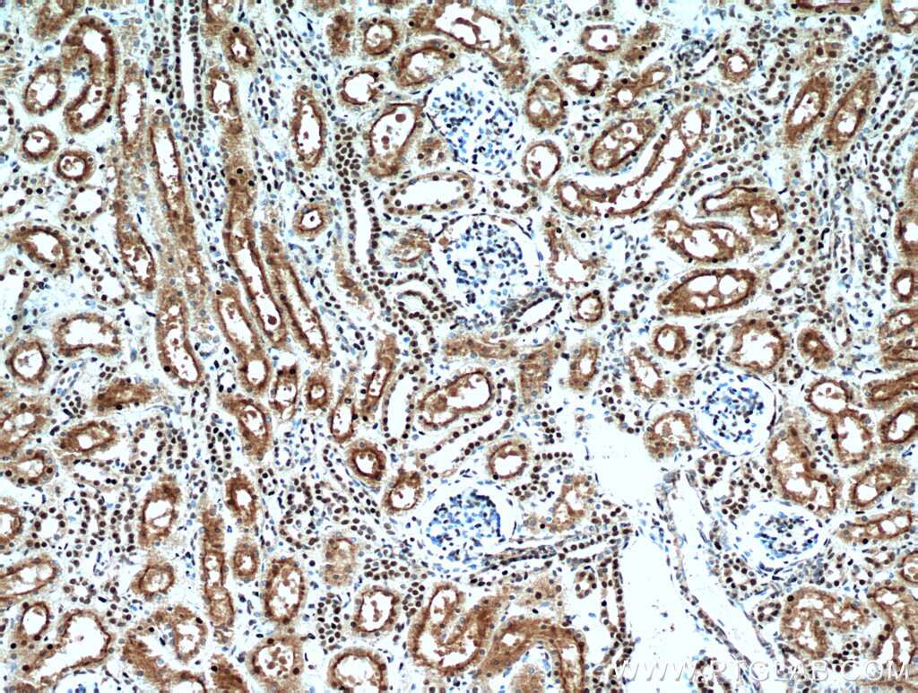 Immunohistochemistry (IHC) staining of human kidney tissue using SET/TAF-I Polyclonal antibody (55201-1-AP)