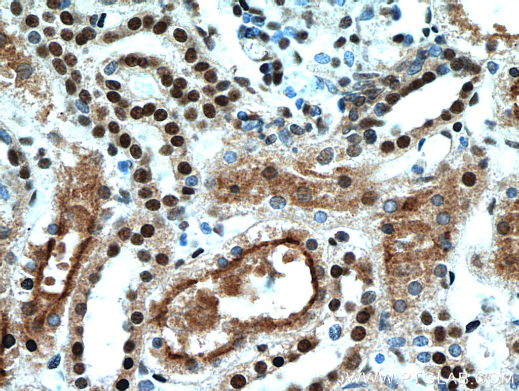 Immunohistochemistry (IHC) staining of human kidney tissue using SET/TAF-I Polyclonal antibody (55201-1-AP)