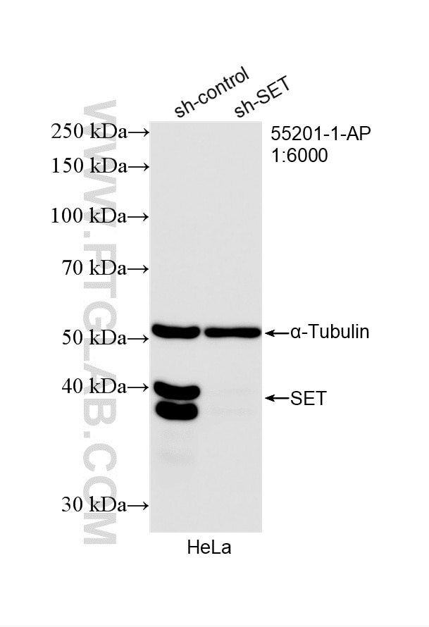 Western Blot (WB) analysis of HeLa cells using SET/TAF-I Polyclonal antibody (55201-1-AP)