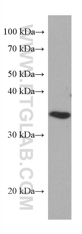 Western Blot (WB) analysis of HeLa cells using SET Monoclonal antibody (67478-1-Ig)