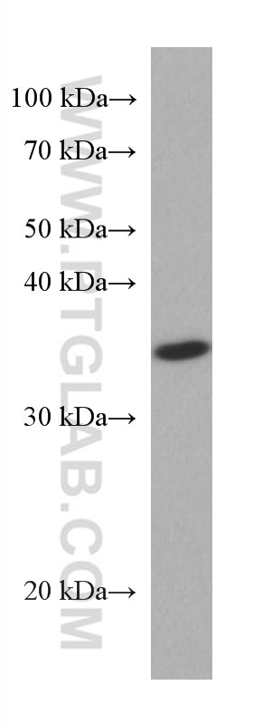 WB analysis of HepG2 using 67478-1-Ig