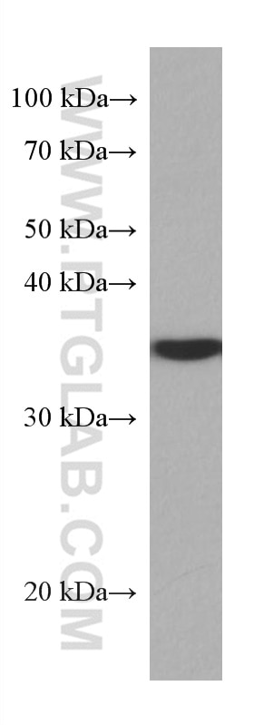 Western Blot (WB) analysis of Jurkat cells using SET Monoclonal antibody (67478-1-Ig)