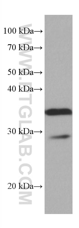 Western Blot (WB) analysis of 4T1 cells using SET Monoclonal antibody (67478-1-Ig)