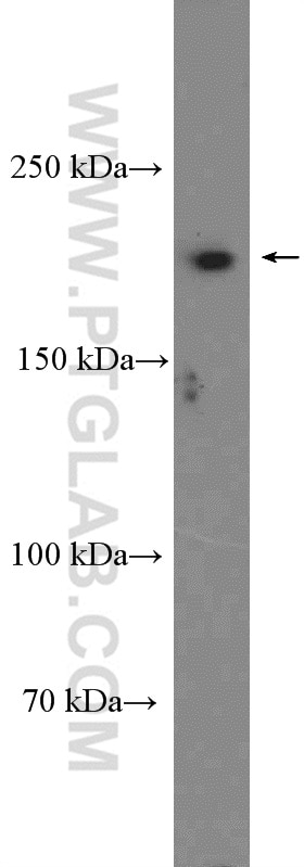 WB analysis of HeLa using 16841-1-AP