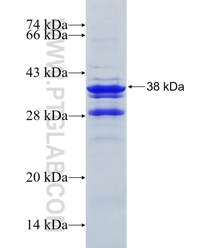 SETBP1 fusion protein Ag10493 SDS-PAGE SETBP1 fusion protein Ag10493 SDS-PAGE