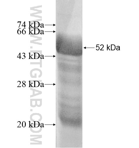 SETBP1 fusion protein Ag10532 SDS-PAGE
