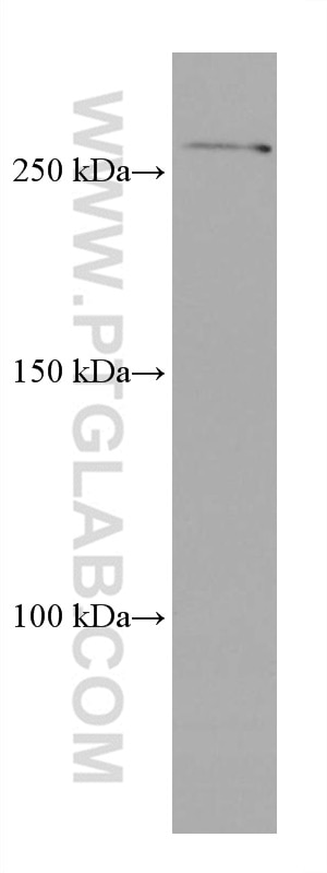 Western Blot (WB) analysis of LNCaP cells using SETD1A Monoclonal antibody (67936-1-Ig)