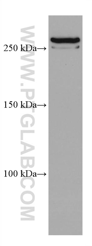 Western Blot (WB) analysis of K-562 cells using SETD1A Monoclonal antibody (67936-1-Ig)