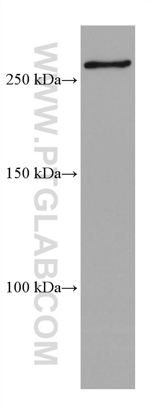 Western Blot (WB) analysis of HSC-T6 cells using SETD1A Monoclonal antibody (67936-1-Ig)