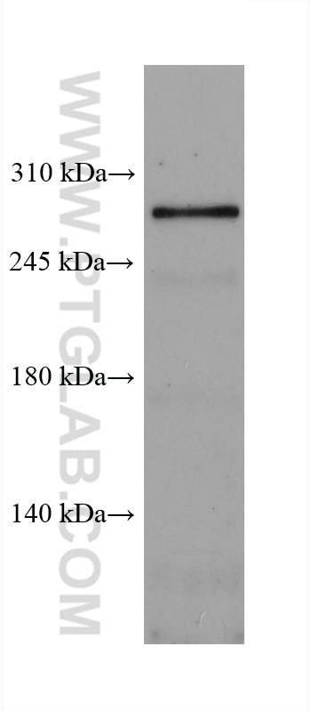 Western Blot (WB) analysis of mouse brain tissue using SETD1A Monoclonal antibody (67936-1-Ig)