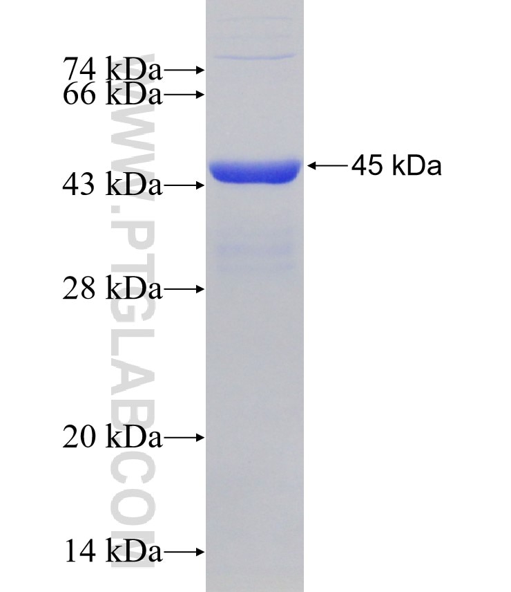 SETD1A fusion protein Ag30424 SDS-PAGE