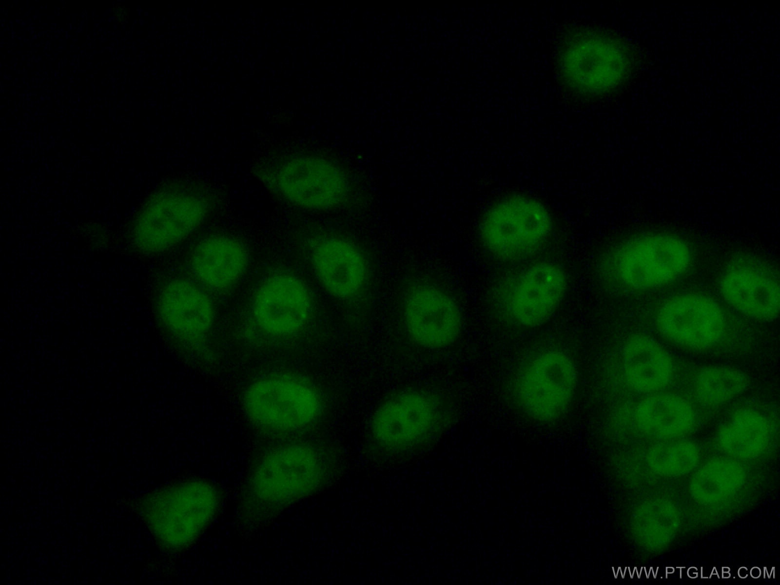 Immunofluorescence (IF) / fluorescent staining of MCF-7 cells using SETD1B Polyclonal antibody (55005-1-AP)